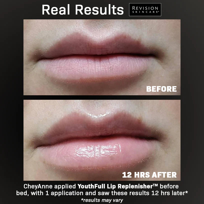 Youthful Lip Replenisher 0.33 oz